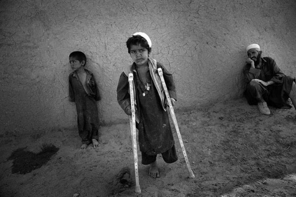 Mahmood, an 8 year old boy living in a refuge camp outside of Ahmadjan village, went out to collect metal scrap in order to earn money for new shoes. He stepped on an unexploded ordnance and lost his leg : Demining in Kabul : Charlotte Oestervang Photography